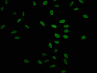 Polyclonal Rabbit anti-Human HIST1H1C Antibody (IF, WB)