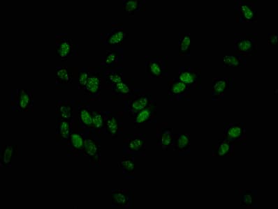 Polyclonal Rabbit anti-Human HIST1H1E Antibody (phospho-Thr179, IF)