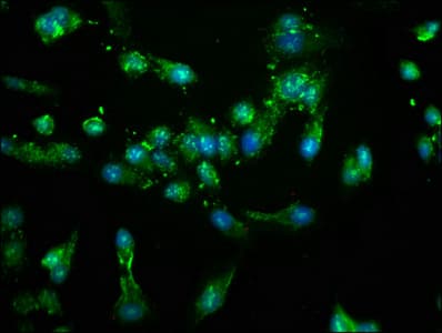 Polyclonal Rabbit anti-Human NEK4 Antibody (IF)