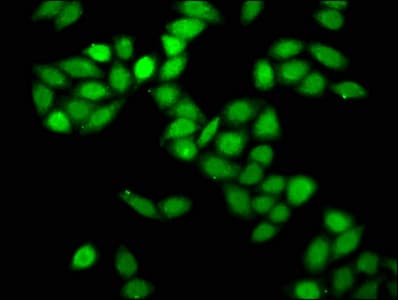 Polyclonal Rabbit anti-Human PRPF8 Antibody (IF)