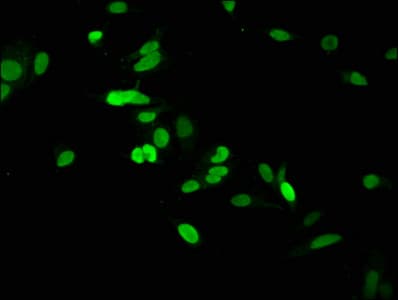 Polyclonal Rabbit anti-Human HIST1H1C Antibody (IF)