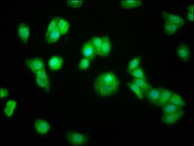 Polyclonal Rabbit anti-Human ZFP36 / Tristetraprolin Antibody (IF)