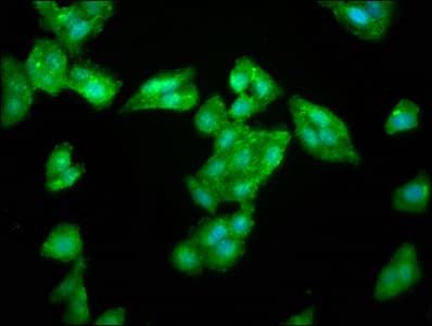 LAS1L Antibody