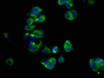 SHROOM2 Antibody