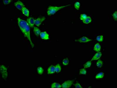 Polyclonal Rabbit anti-Human CHRNB2 Antibody (IF, WB)