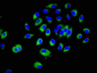 Polyclonal Rabbit anti-Human CRK Antibody (IF, WB)