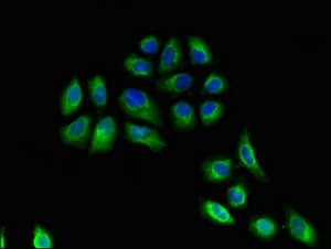 HLA-DRB3 Antibody