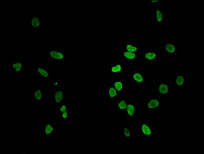 Polyclonal Rabbit anti-Human HIST1H1C Antibody (IF, WB)