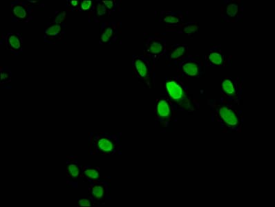 Polyclonal Rabbit anti-Human HIST1H1E Antibody (IHC, IF, WB)