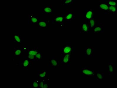 Polyclonal Rabbit anti-Human HIST1H1E Antibody (IF)