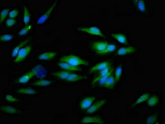 Polyclonal Rabbit anti-Human ITGAV/Integrin Alpha V/CD51 Antibody (IHC, IF, WB)