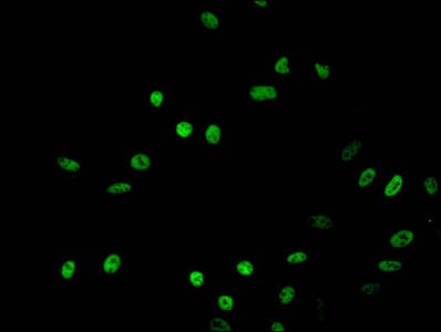 Polyclonal Rabbit anti-Human HIST1H2BB Antibody (IHC, IF)