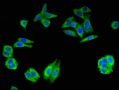 Polyclonal Rabbit anti-Human GCLM Antibody (IHC, IF, WB)