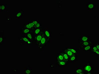 Polyclonal Rabbit anti-Human STAT6 Antibody (IHC, IF)