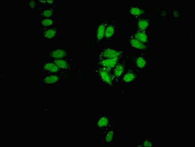 Polyclonal Rabbit anti-Human CBX3 / HP1 Gamma Antibody (IF)