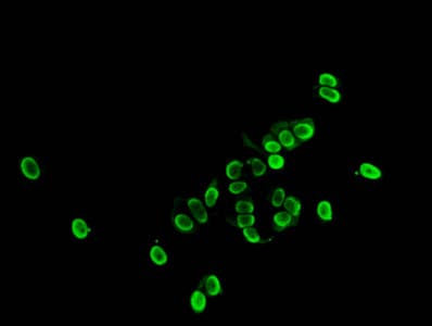 Polyclonal Rabbit anti-Human HIST1H1E Antibody (IF)