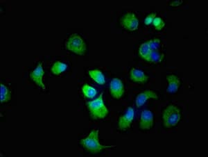 SLC22A2 Antibody