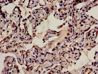 BRD8 Antibody