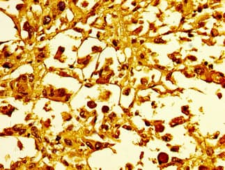 Polyclonal Rabbit anti-Human HIST1H1C Antibody (IHC, IF, WB)
