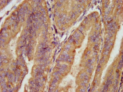 AARS Antibody