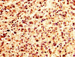 Polyclonal Rabbit anti-Human CXCL4 / PF4 Antibody (IHC)