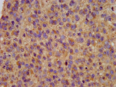 KCNE3 Antibody