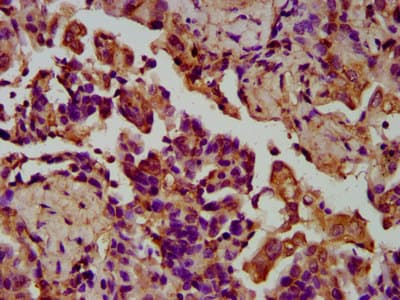 LGI4 Antibody