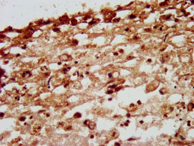 Polyclonal Rabbit anti-Human NID1 / Entactin / Nidogen-1 Antibody (IHC)