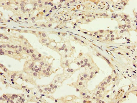 GDI1 Antibody