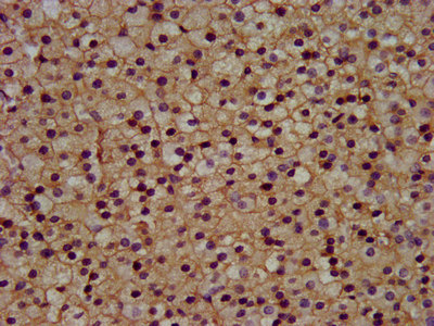 Polyclonal Rabbit anti-Human KCNJ5 / Kir3.4 / GIRK4 Antibody (IHC, IF, WB)