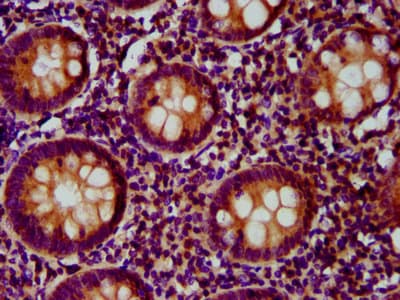 FCHO1 Antibody