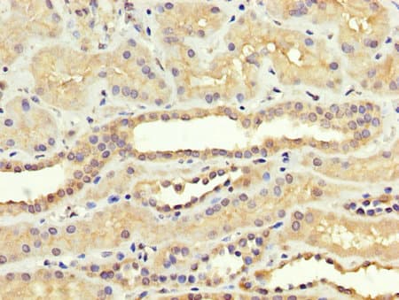 Polyclonal Rabbit anti-Human SREBF1 / SREBP-1 Antibody (IHC)