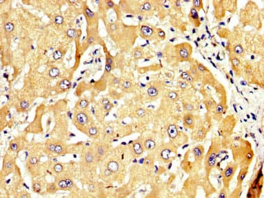 RECK Antibody