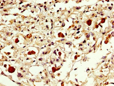EXOSC10 Antibody