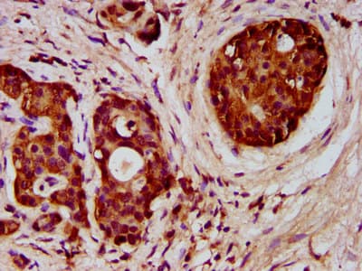 FCHO1 Antibody