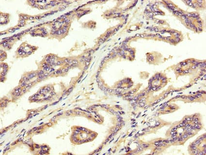 Polyclonal Rabbit anti-Human SREBF1 / SREBP-1 Antibody (IHC)