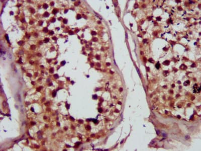 MVD Antibody