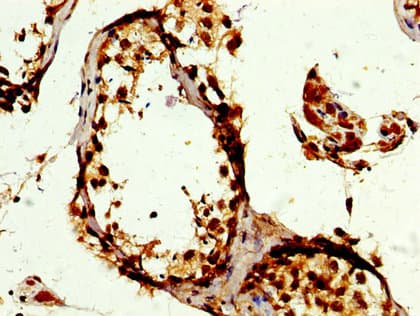 Polyclonal Rabbit anti-Human POLD3 Antibody (IHC, WB)