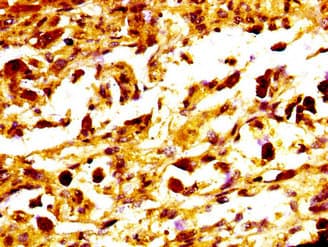 Polyclonal Rabbit anti-Human MC1R Antibody (IHC, WB)