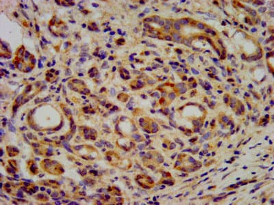 KIF20B Antibody