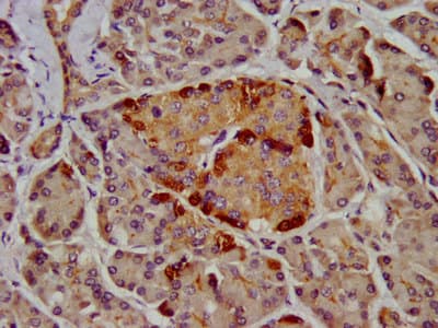 Polyclonal Rabbit anti-Human CLPS / Colipase Antibody (IHC)