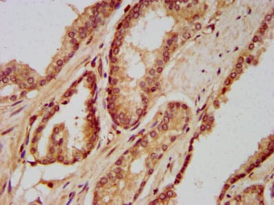 SETD3 Antibody