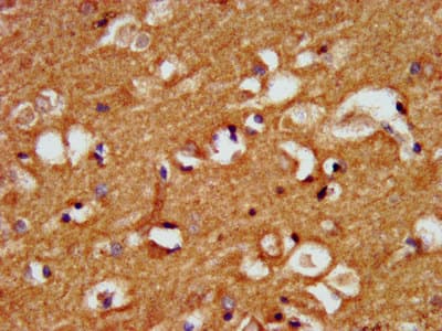 Polyclonal Rabbit anti-Human CRYM Antibody (IHC, IF)