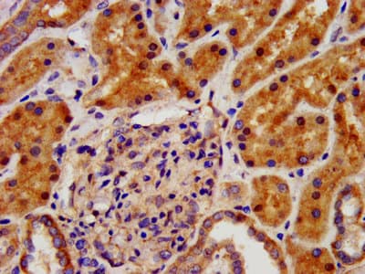 Polyclonal Rabbit anti-Human CRYM Antibody (IHC, IF)