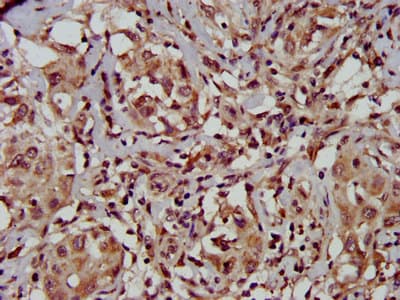 TFB1M Antibody