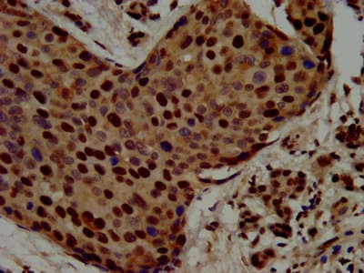 RALY Antibody