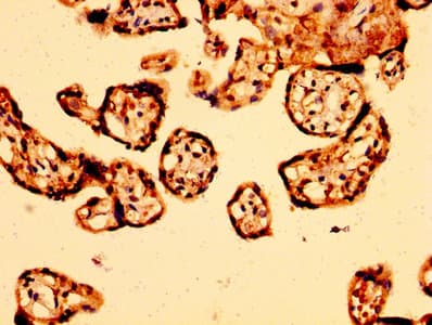ARHGEF11 Antibody