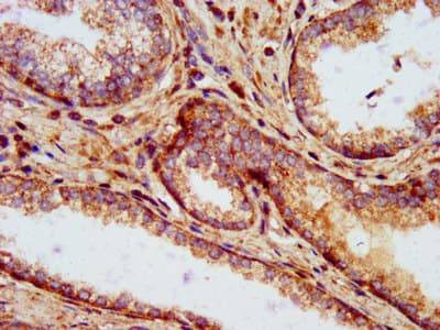 CLPP Antibody