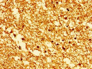Polyclonal Rabbit anti-Human HIST1H1E Antibody (IHC)