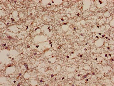 Polyclonal Rabbit anti-Human NQO2 Antibody (IHC, IF, WB)